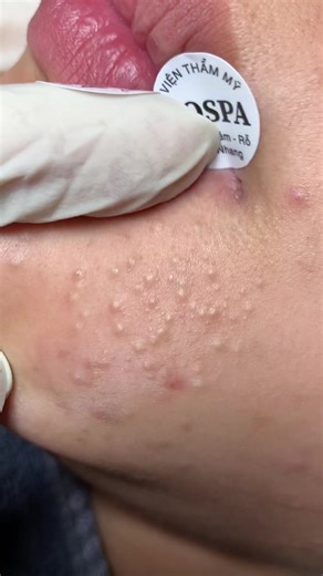 Comprehensive Guide to Skin Care for Women