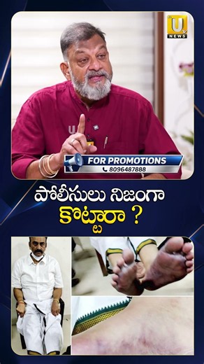 పోలీసులు నిజంగా కొట్టారా ? #raghuramkrishnamraju #custody #ycpgovt #ksprasad #viral #ytshorts