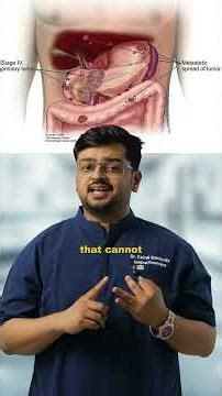 When is surgery not an option in pancreatic cancer