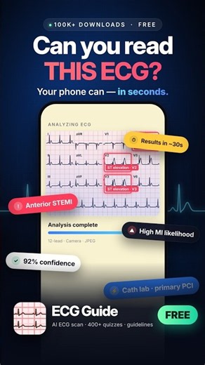 ECG interpretation just got faster, smarter, and more interactive.