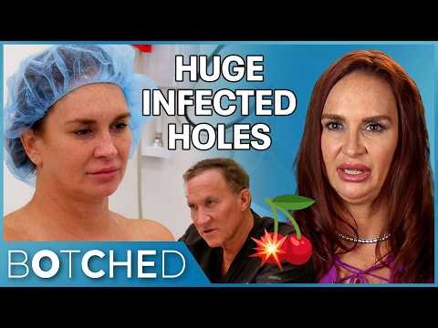 Tanna Had HUGE Infected Holes In Her Boobs After Removing Her Implants | Botched | E!