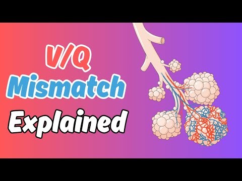 V/Q Mismatch (Ventilation-Perfusion Ratio) | Dead Space vs Shunt