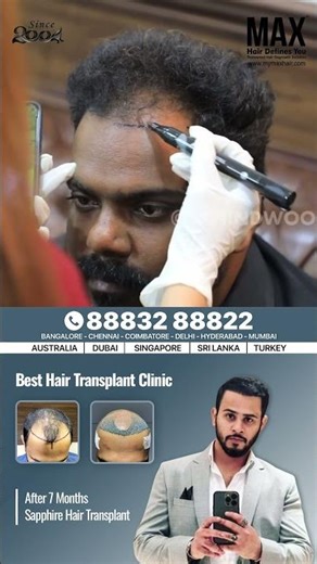 " i wanted to recreate my old hairline" ] best hair transplant clinic in India