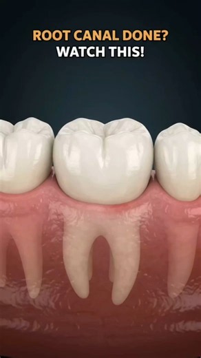 5 Warning Signs of a Failing Root Canal Tooth 🦷 #Short