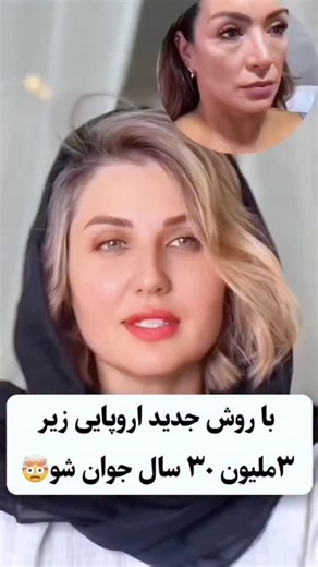 ‎مربی جوانی و زیبایی صورت | صفحه رسمی امین خلیفه‎ on Instagram‎: "با یک بار اسـ.ـتفاده، هرچی چـ..روک و افـ..تادگی داری رو ازبین میبره و چند درجه پوسـ..تتو روشن و سفید میکنه😍 عدد ( ۸ ) رو کامـ..نت کن تا اطلاعات کاملشو برات ارسال کنم❤️ فقط پیـ.ـجمو فـ..الو داشته باش تا بتونم بهت پیـ..ـام بدم🙏⁩⁩⁩⁩⁩⁩⁩⁩⁩"‎