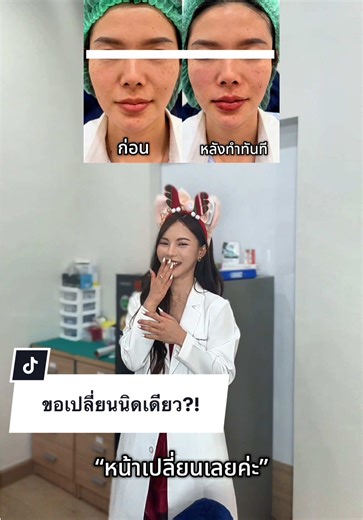 โปรแกรมปรับรูปหน้าทั่วหน้า เปลี่ยนนิดเดียว?! 🌷✨ มาปรับรูปหน้าที่ Kay Clinuc กันนะคะ สาขาอุดรธานีเปิดแล้วเด้อค่า 💓✨ #รีวิวบิวตี้ #รีวิวอุดร #คลินิกเสริมความงาม #สวยพุ่งจนต้องแชร์ #ฟิลเลอร์