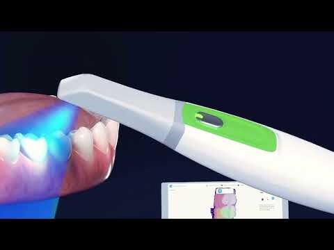 SCAN11 Intraoral Scanner | Digital Dentistry Starts Here