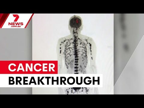 Sydney scientists capture immune cells devouring cancer | 7NEWS