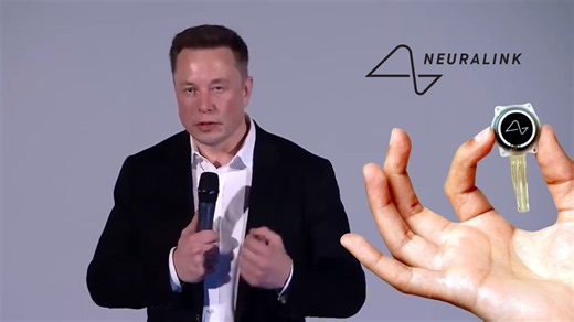 Elon Musk’s Neuralink just got FDA approval to put its brain chip in humans