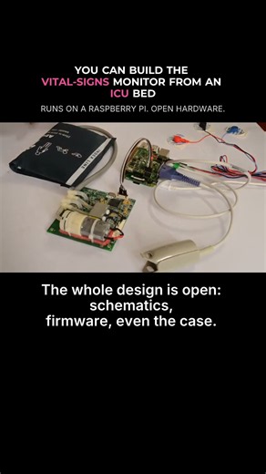 You can build the vital signs monitor from an ICU bedside - it runs on a Raspberry Pi