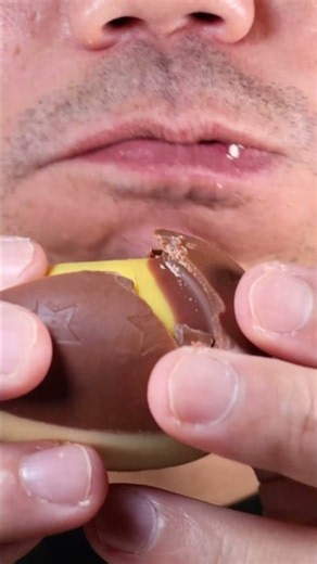 ASMR | LOL Surprise Chocolate Egg 🐣 #DoctorTristanPeh #ASMR