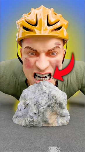 How The Dentist Restores Broken Teeth 😨