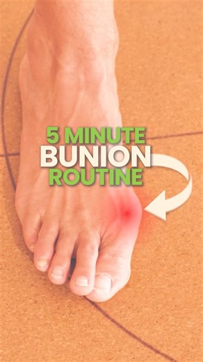 Bunions are often a sign your big toe has lost ability to move & load properly, not a life sentence