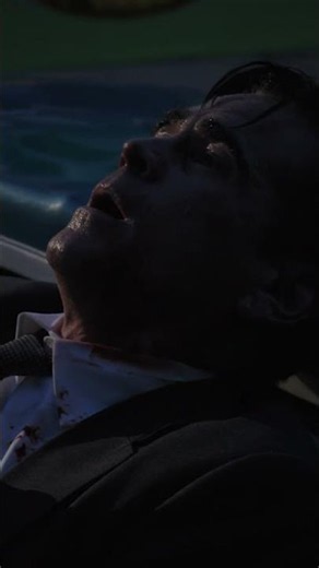 Just a flesh wound. #Sugar