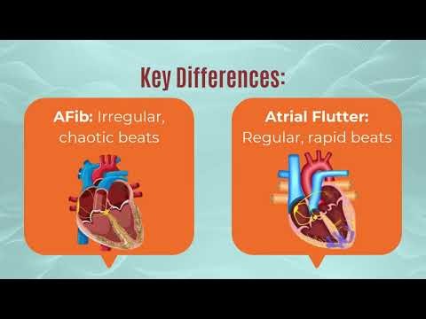Atrial Fibrillation vs. Atrial Flutter Understanding the Key Differences