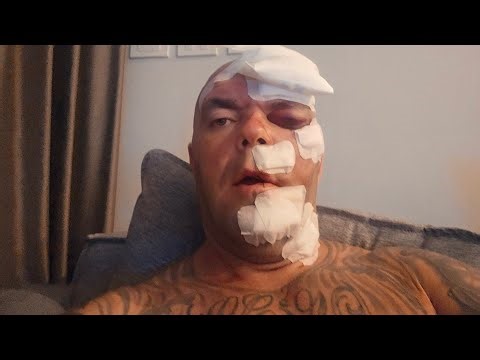 Update from Hospital about bleed on the brain brain. Ricky killeen 