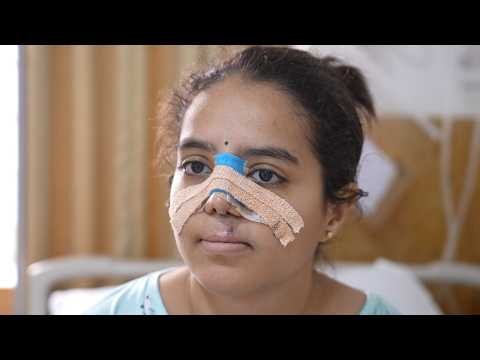Crucial Surgery for Facial Beauty for a Girl in India