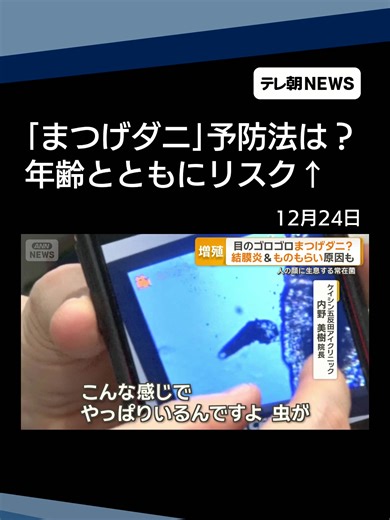 目のゴロゴロ「まつげダニ」？結膜炎＆ものもらい原因も 加齢とともに有病率が上昇 #テレ朝NEWS #tiktokでニュース