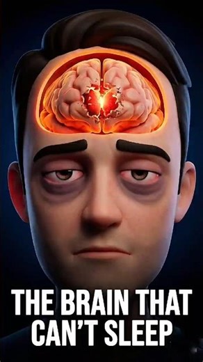 The Disease That Deletes Your Sleep 😱