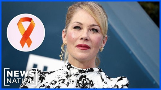 Expert explains how Christina Applegate's MS misdiagnosis can happen
