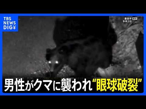 男性（59）がクマに襲われ大けが  愛知・豊田市の住宅｜TBS NEWS DIG