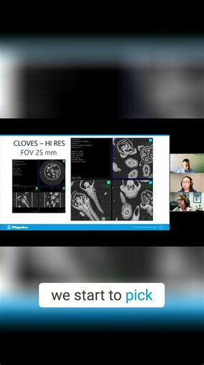 HI RES Cloves Scan Blurry to Crystal Clear in Seconds!