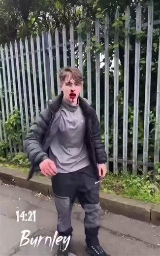 The stabbing attack on a 17yr old girl in Burnley comes only days after a teenage boy was attacked in the same area by an invader from a HMO housing them at the taxpayers expense.The boy was hit in the face with a brick multiple times and was captured fleeing covered in blood!
