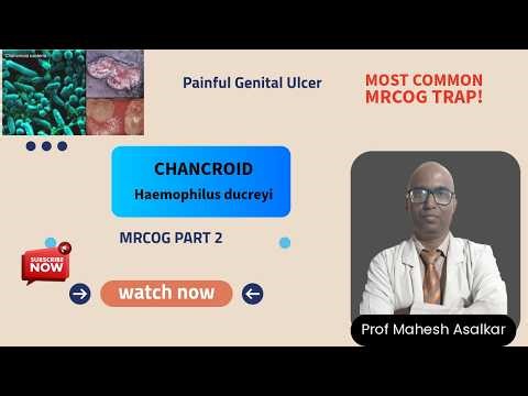 Chancroid Made Easy for MRCOG Part 2 | Painful Genital Ulcer | SRH Module Revision
