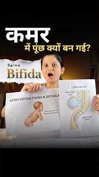 Spina Bifida Occulta: The Hidden Condition Parents Must Know