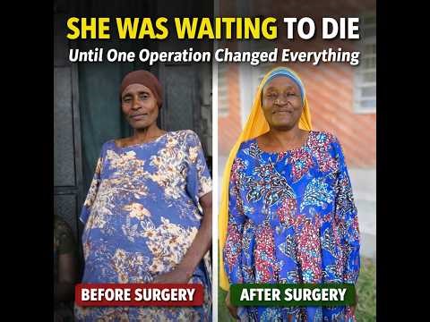 She Lived With a Massive Cyst for years, then One Surgery Changed Everything.