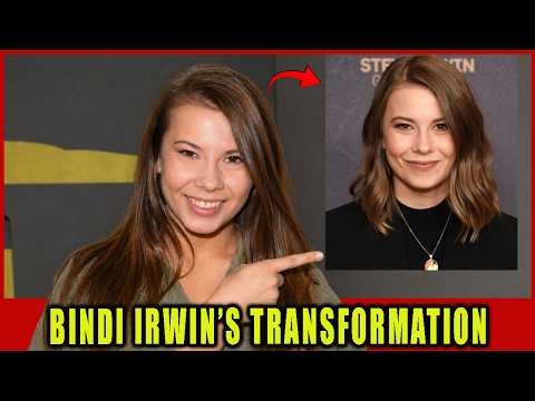 Bindi Irwin Was Smiling for Years While Hiding UNBEARABLE Pain