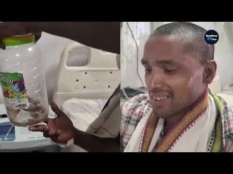 Man Trusts Snake Dream, Gets Bitten and Rushes to Hospital #viralnews