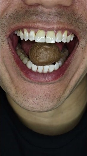 ASMR | Oreo Egg… So Satisfying 🍫 #DoctorTristanPeh #ASMR
