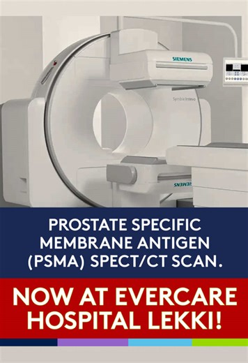 Advanced PSMA SPECT/CT Scan for Prostate Cancer Detection