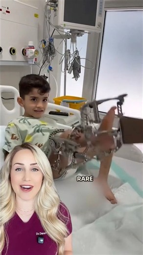 How THIS is saving his leg!
