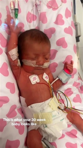 32 Weeks Premature Baby Life Journey😢😭 #prematurebaby #baby #newbornbaby #newborn #32weeksbaby