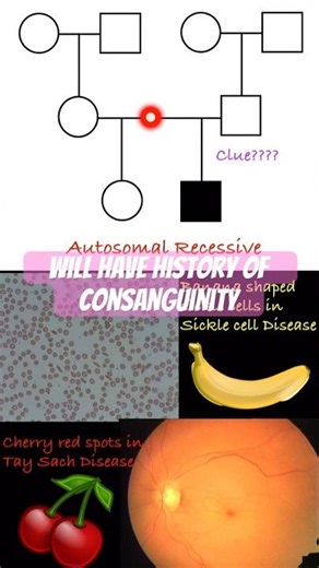 Autosomal Recessive Disorder Pedigree #neetpg #neet #mbbs #pathology #inicet #pedigree