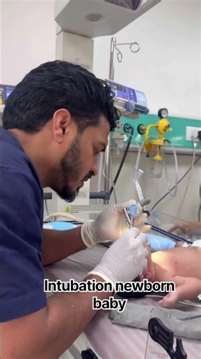 Emergency Intubation newborn baby after the birth ( RDS )# #comment #shortsviral (fast recovery10d