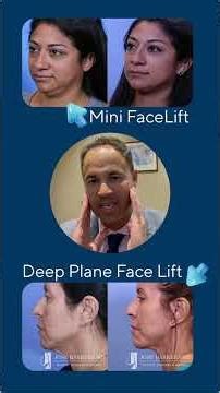 Deep Plane vs. Mini Facelift