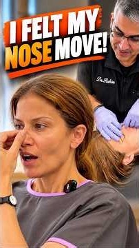 “I FELT MY NOSE MOVE!” 😳 | Deviated Septum Adjustment | Dr. Rahim