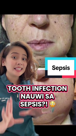 Why You Should Never Ignore a Dental Abscess — Signs, Risks, and When to Seek Help