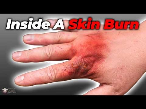 Your Skin Burns a Lot Faster Than You Think