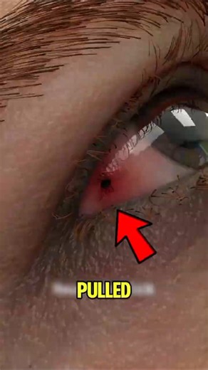 Scientists Just Discovered How Ticks Really Get Onto You