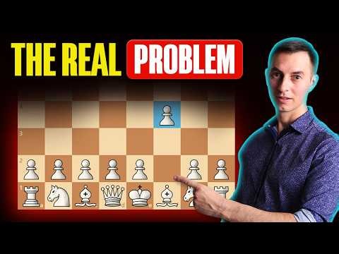 5 Opening Mistakes That RUIN Your Chess Games