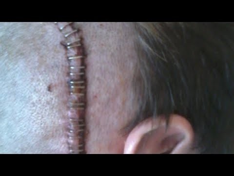 (AgeRestricted21+)CanADoctorOperateOnYouWithoutYourPremissionViloationBecauseOfAMildDisablity?