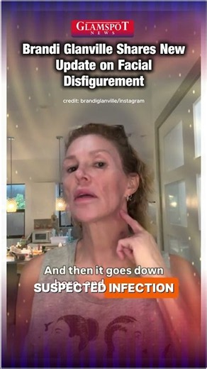 Brandi Glanville’s “Face Taken Off” Comment Explained