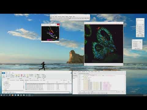 【HereIm】IM00010 Mitochondrial Fission Finder {CN}_fix