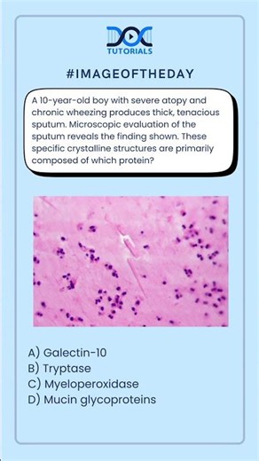 These specific crystalline structures are primarily composed of which protein?