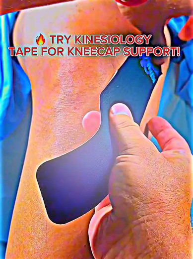 ▲ KNEECAP PAIN? YOUR KNEE IS TRYING TO TELL YOU SOMETHING! ▲ Pain when walking, squatting, climbing stairs, or bending your knee? ★ STOP IGNORING THAT PAIN! Your kneecap (patella) is essential for smooth knee movement. When the surrounding muscles and tendons become overloaded, every step can become uncomfortable. TRY KINESIOLOGY TAPE FOR KNEECAP SUPPORT! Provides gentle, flexible support around the kneecap May help reduce knee discomfort during movement Supports the surrounding muscles and soft