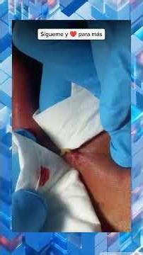 Looks painful 😖